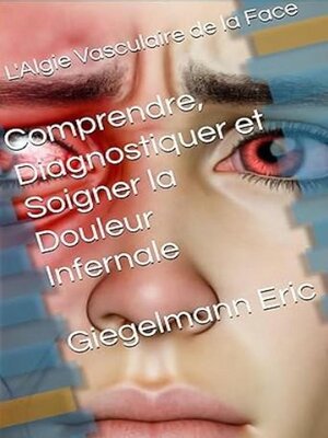 cover image of L'Algie Vasculaire de la Face